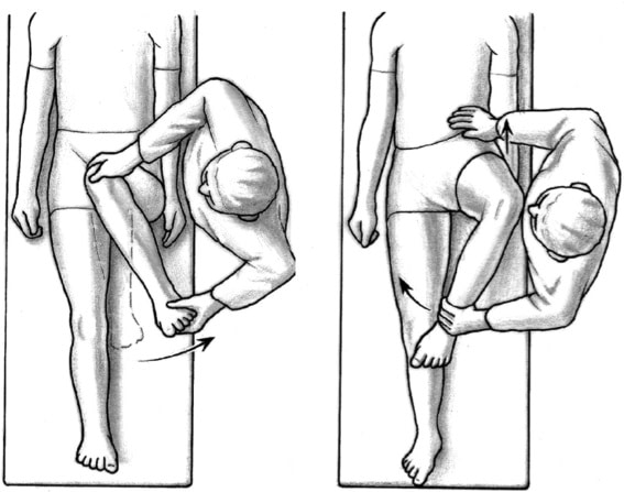 pijn knieen squatten