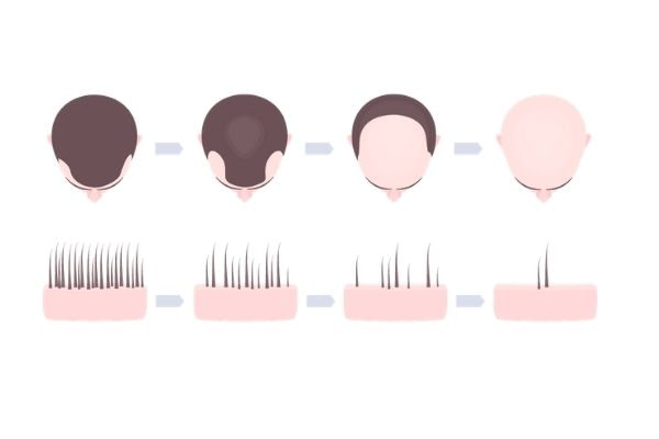 creatine kaal worden