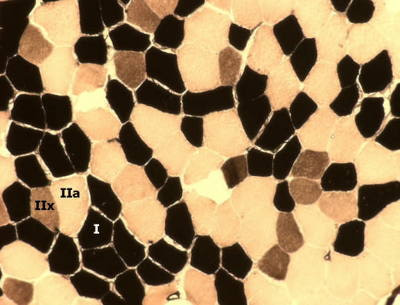 spiervezeltype samenstelling